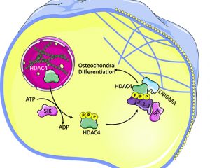 Phosphorylation by SIK results in cytoplasmic localization of HDAC4 