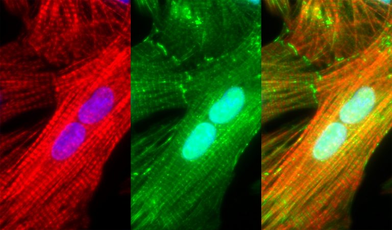 Growth an maintenance of the sarcomere | Kehat Lab