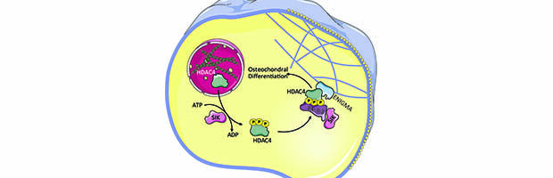 Cytoplasmic HDAC4 promotes vascular calcification